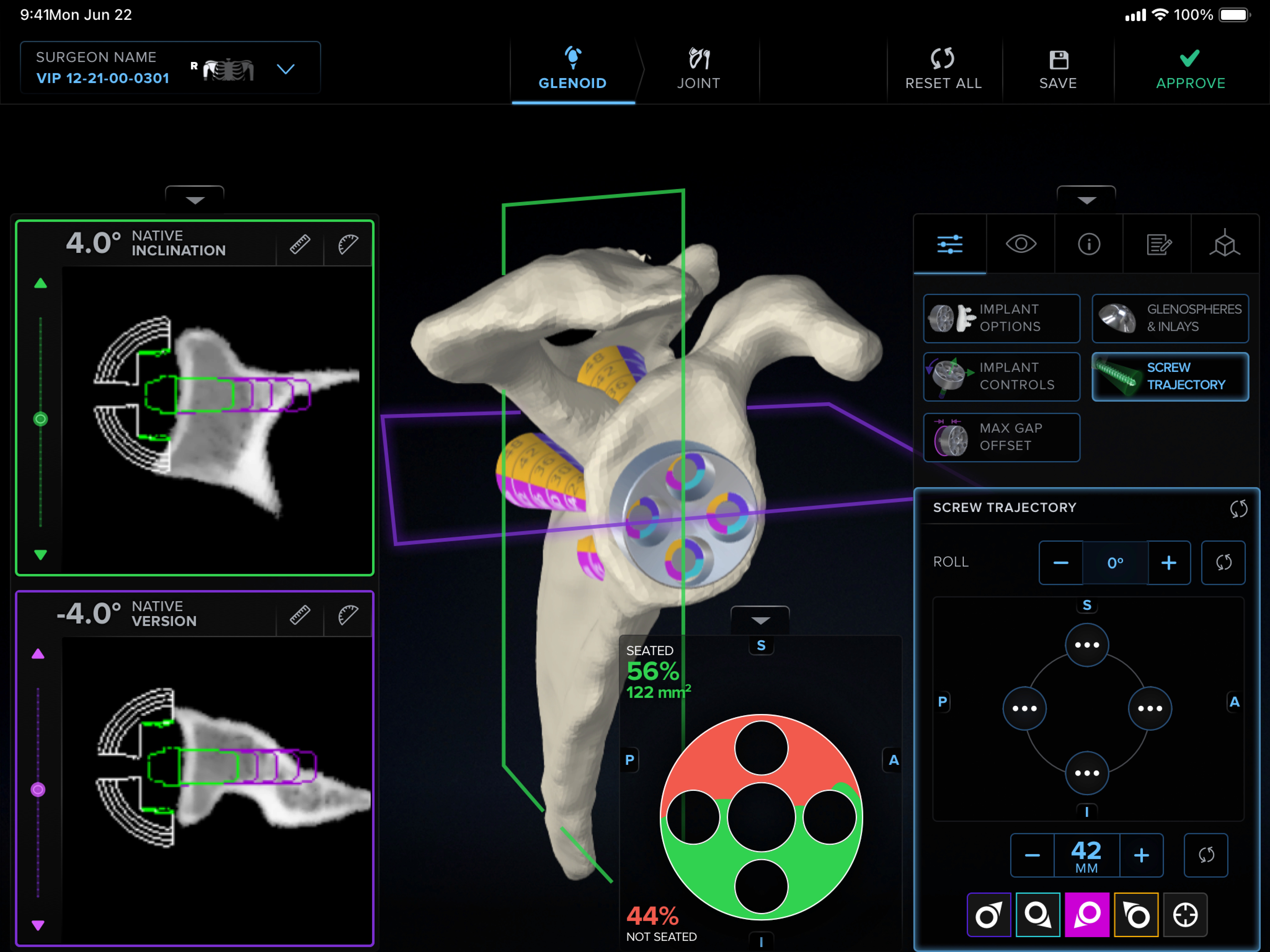 A device-testing pop-up between live surgeries, or the cadaver lab setup with 3D-printed anatomical parts