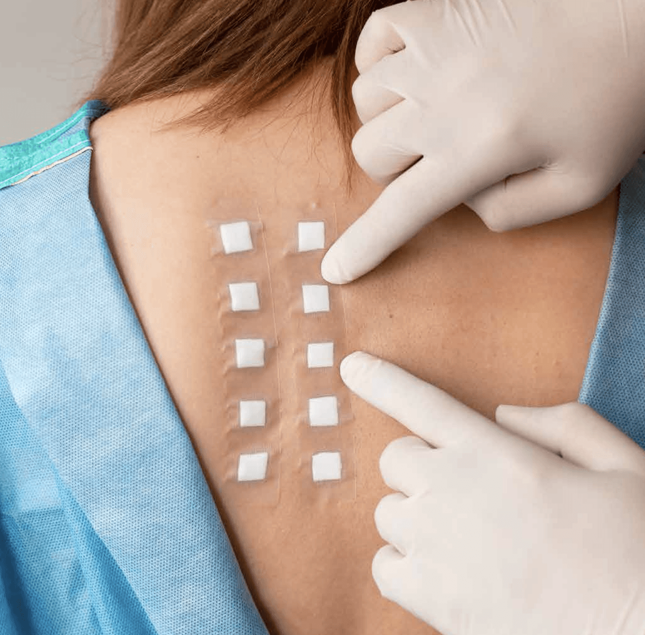 Adhesivos medicos