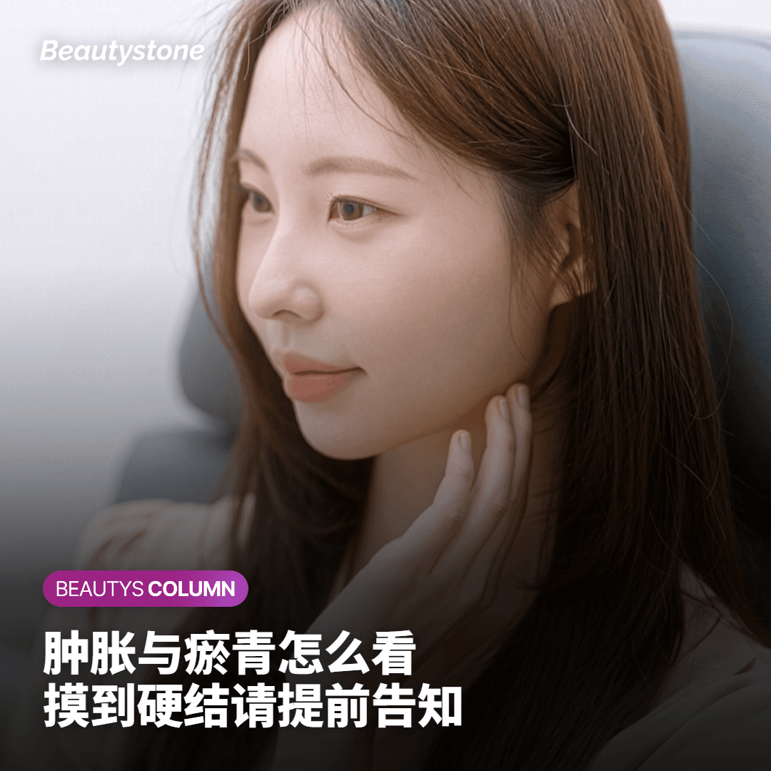 总结 Sculptra 注射后副作用与观察要点的卡片