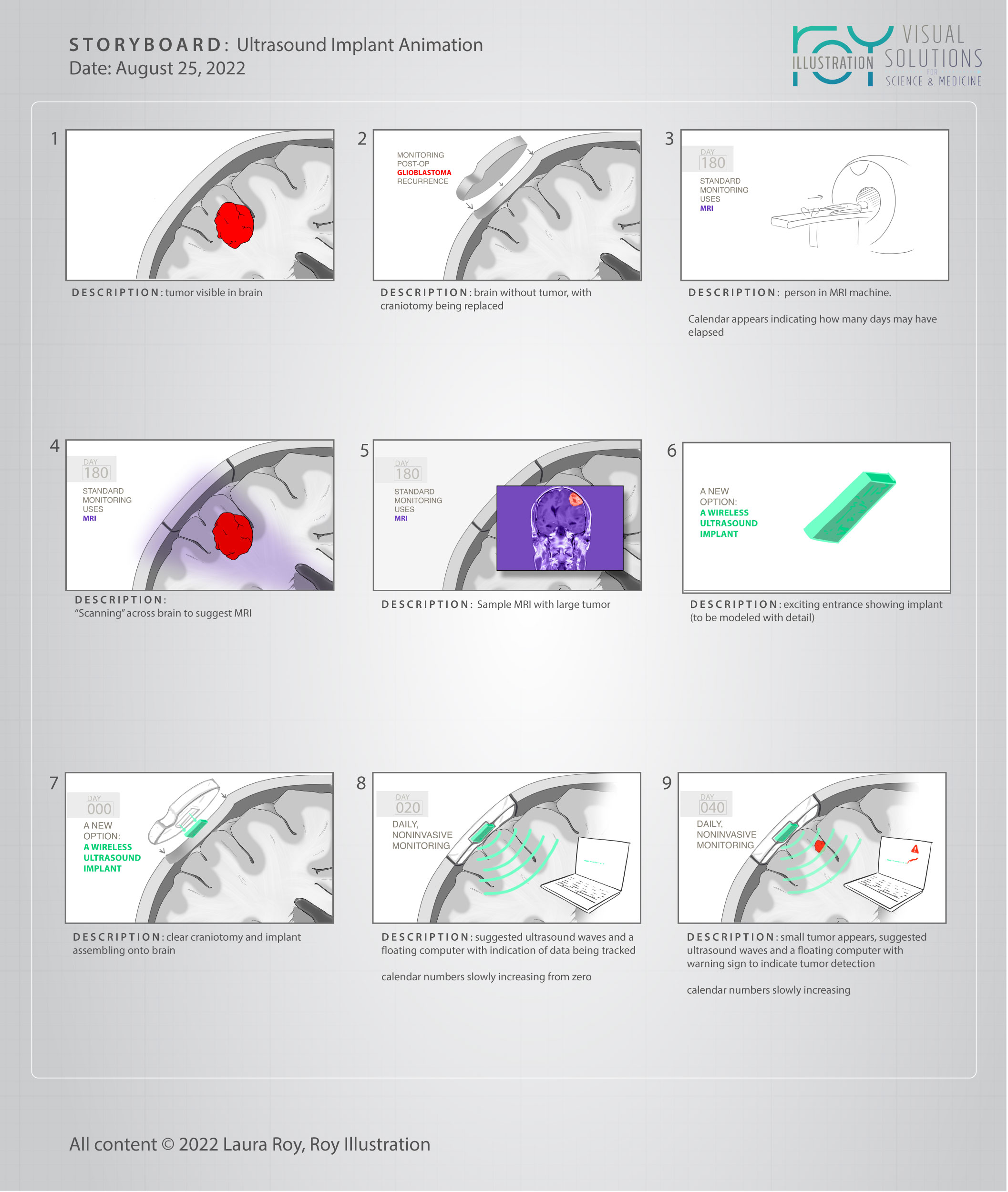 Cranial Implant Animation Storyboard