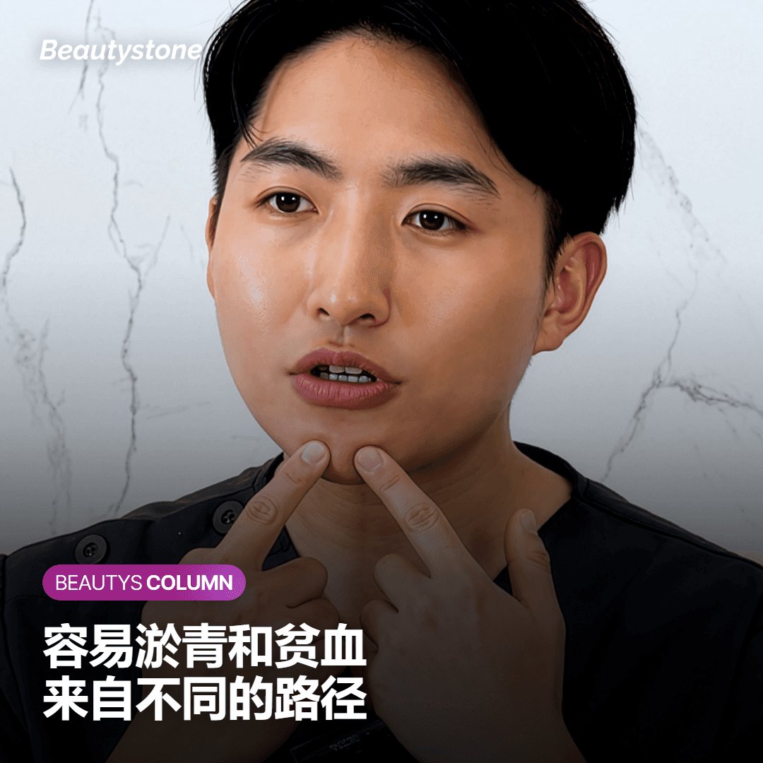 容易淤青和贫血是同一件事吗
