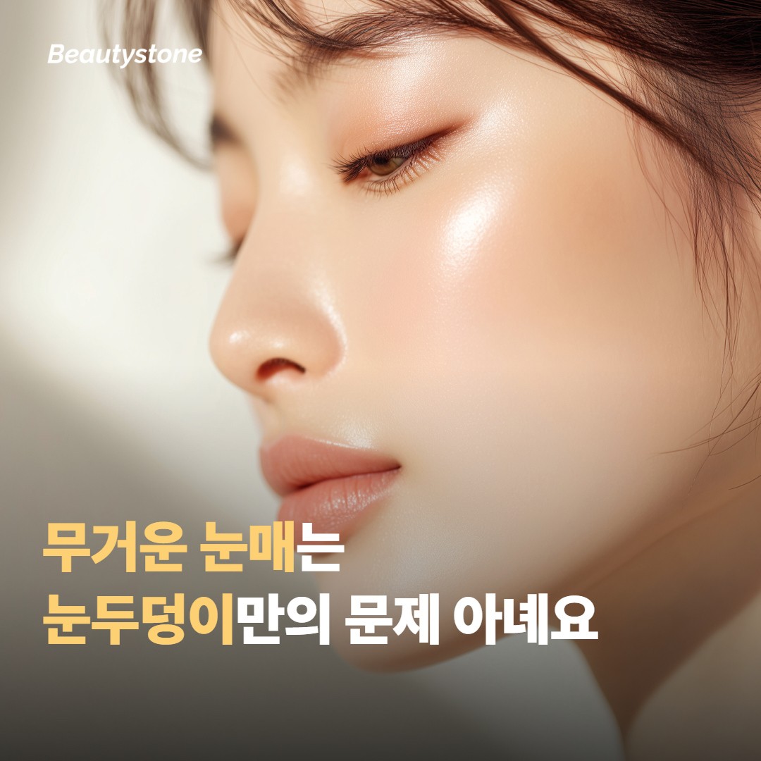 눈매가 무거워 보이는 건 눈두덩이만의 문제가 아니에요