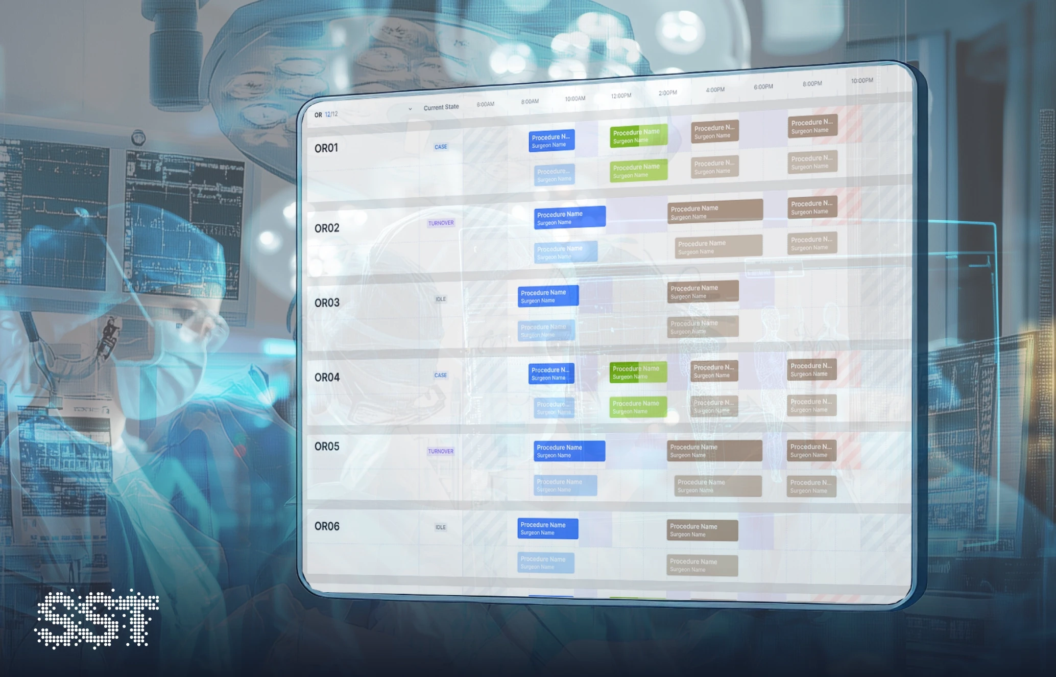 Room State OR schedule chart