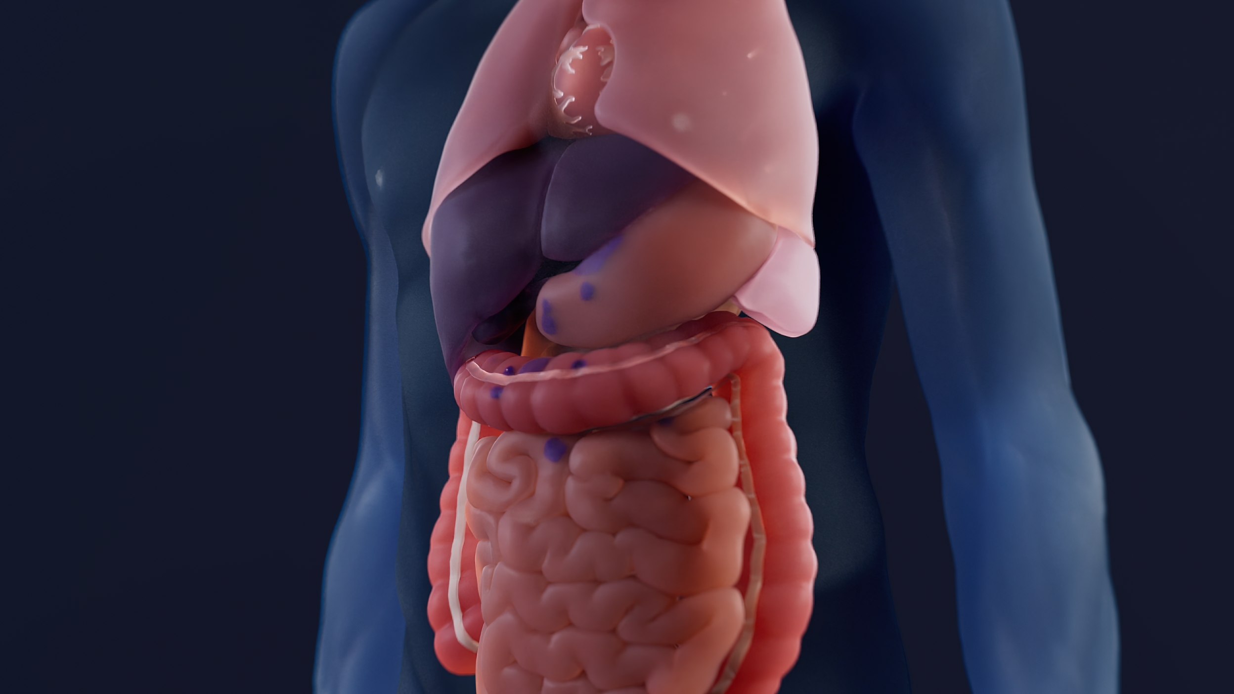 Visualization of the human body with organs and tumor sites visible inside