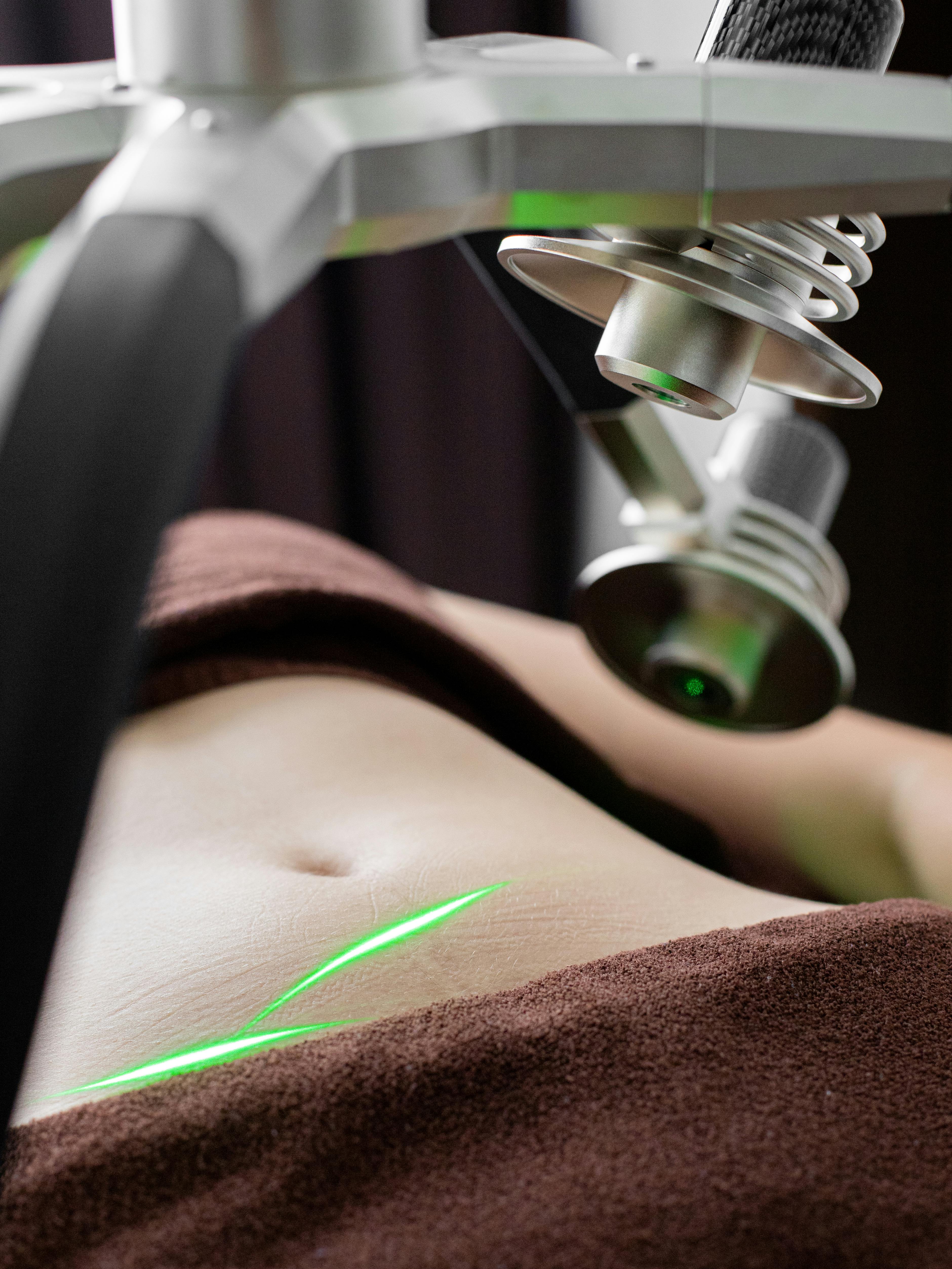 Non-invasive body contouring treatment using specialized equipment