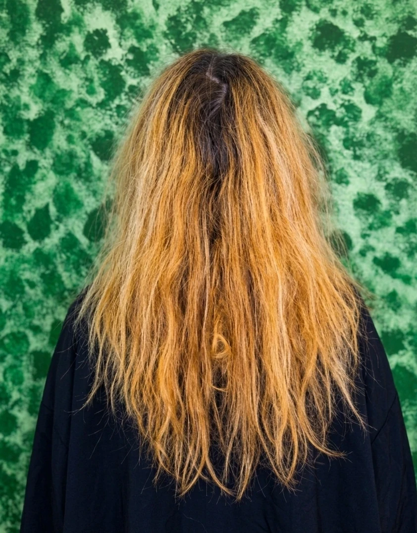 Close-up of smile showing yellowed teeth