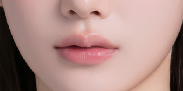 입술필러 황금비율 설명