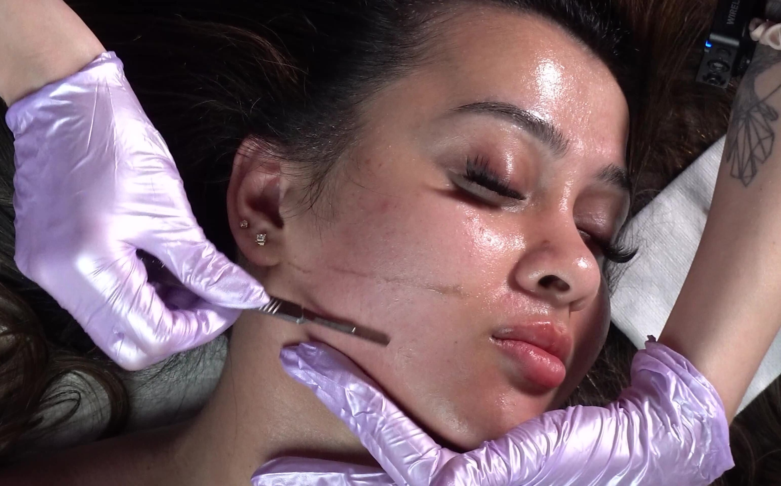 SkinBetter Peel to pair with dermaplaning