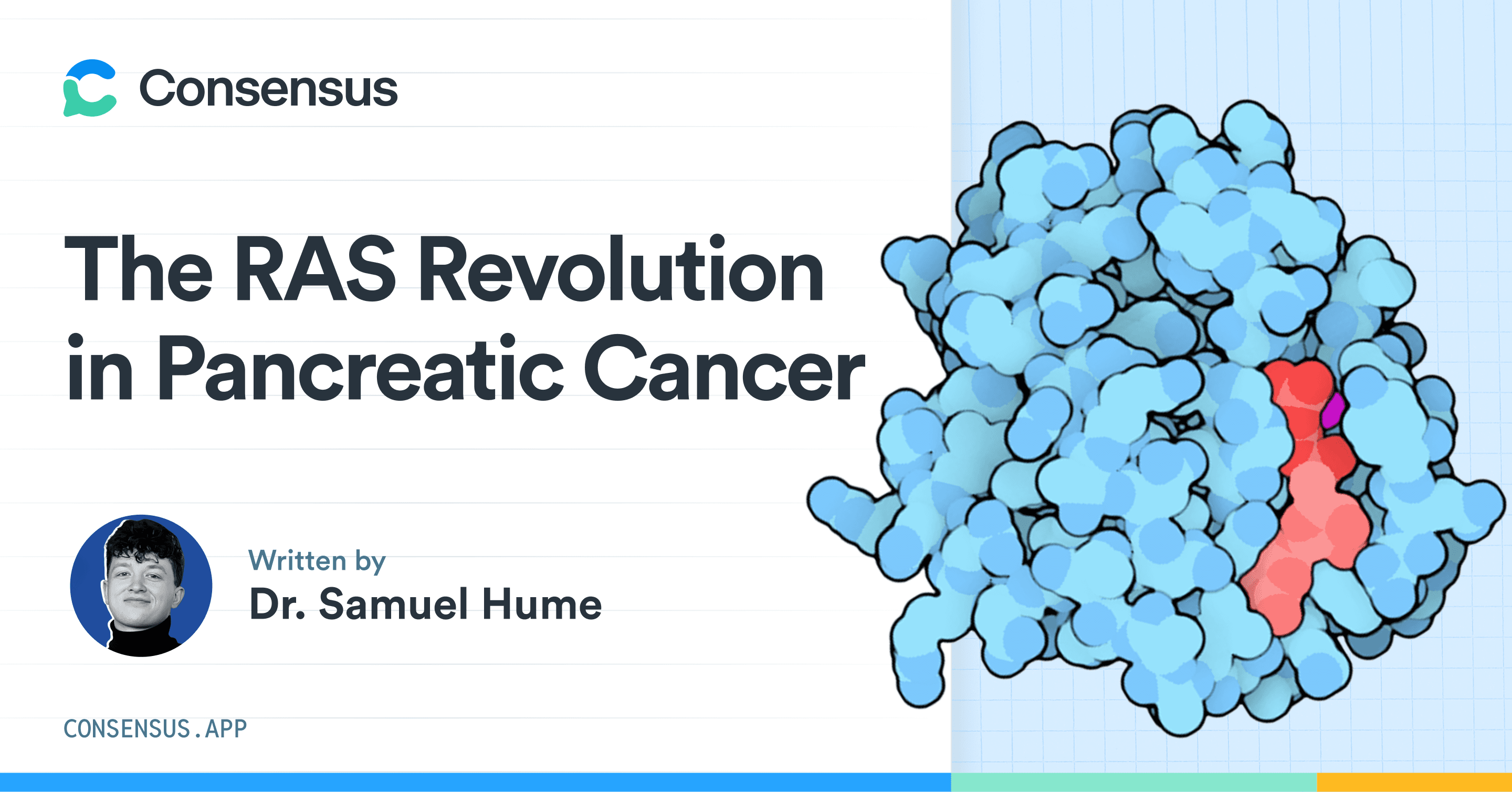 Consensus — The RAS Revolution in Pancreatic Cancer, written by Dr. Samuel Hume. Illustration of the RAS protein.