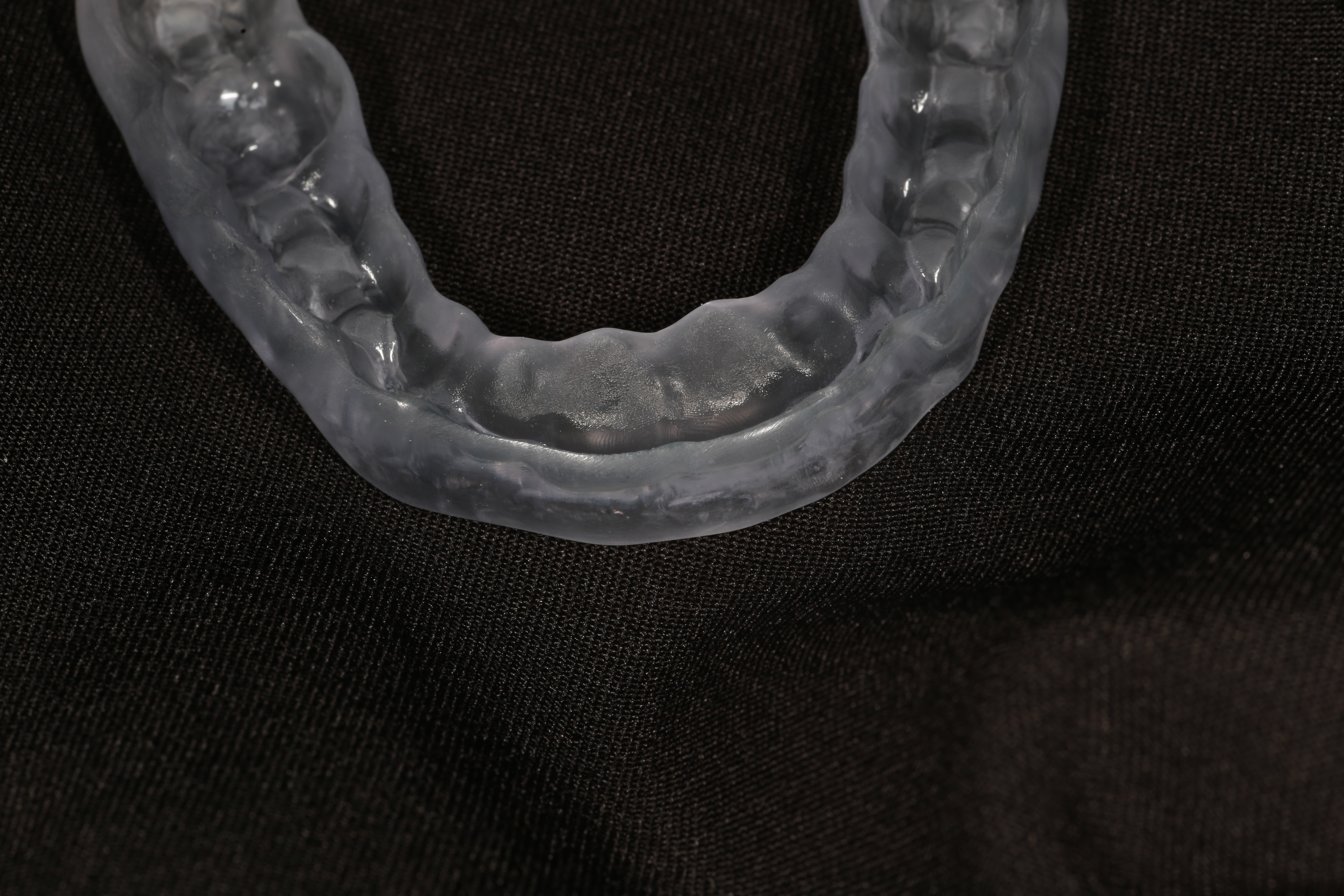 Occlusal splint — night guard