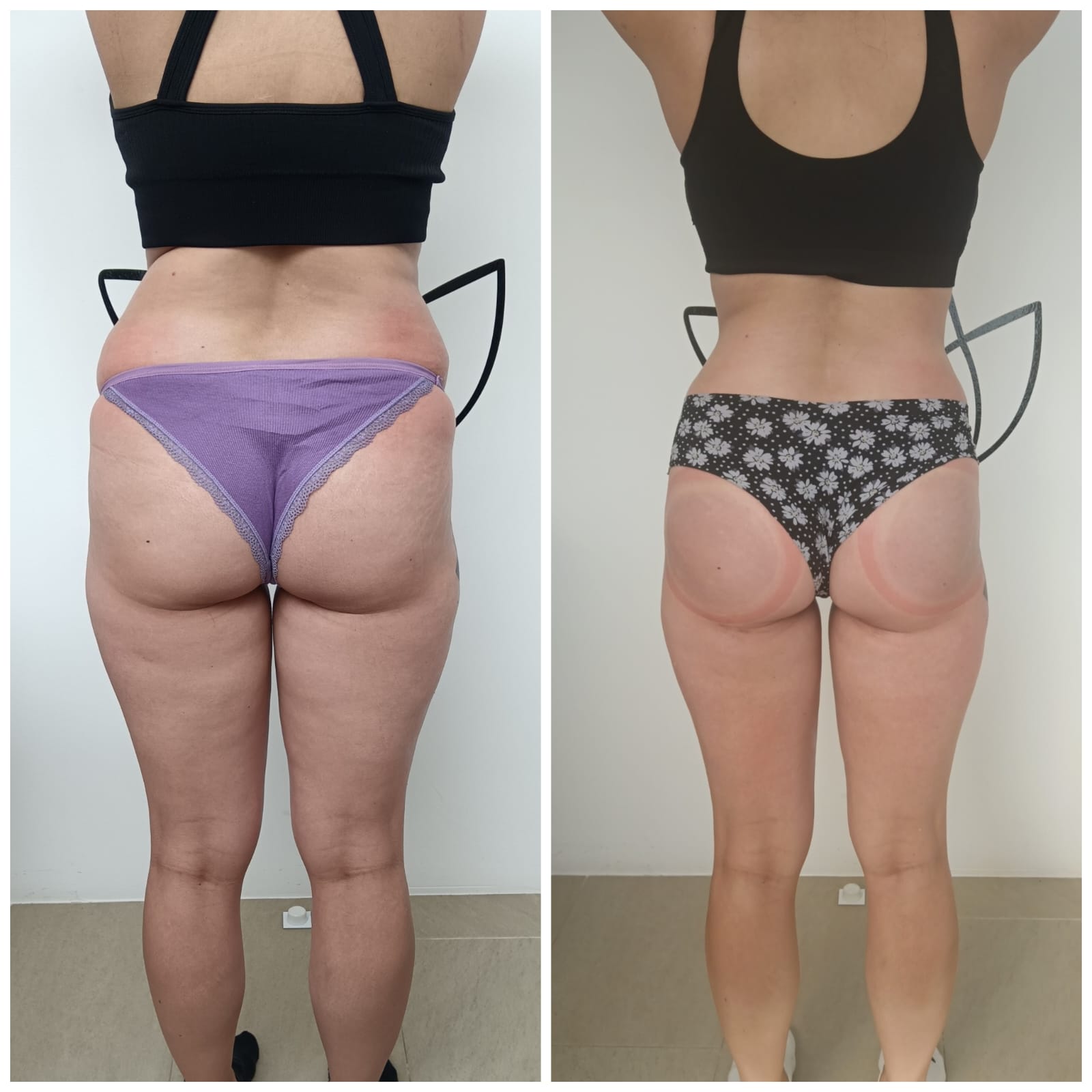 Transformation Photo