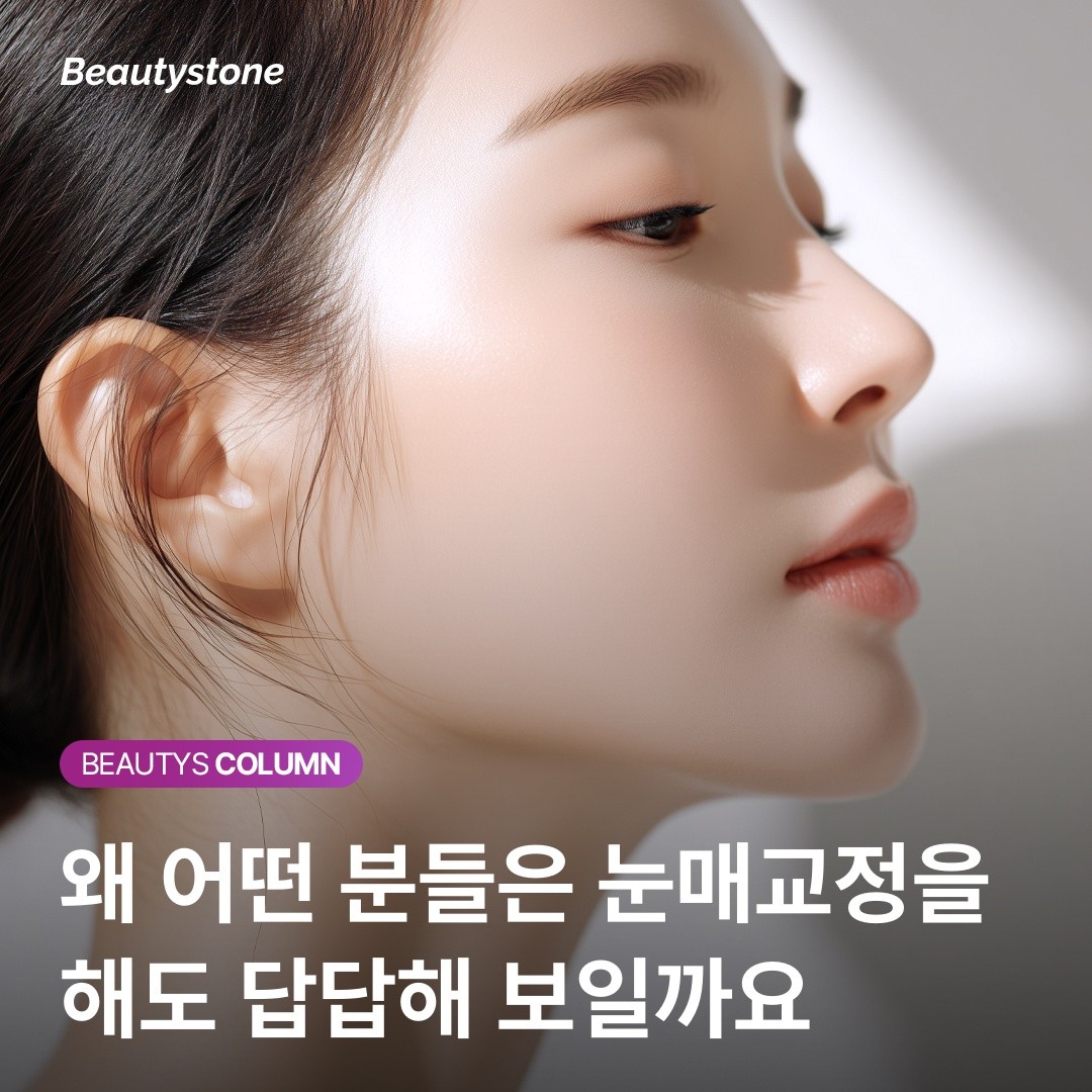 홍대 위영진 원장의 조언: 눈매교정 재수술 전 관자놀이 꺼짐부터 체크하세요