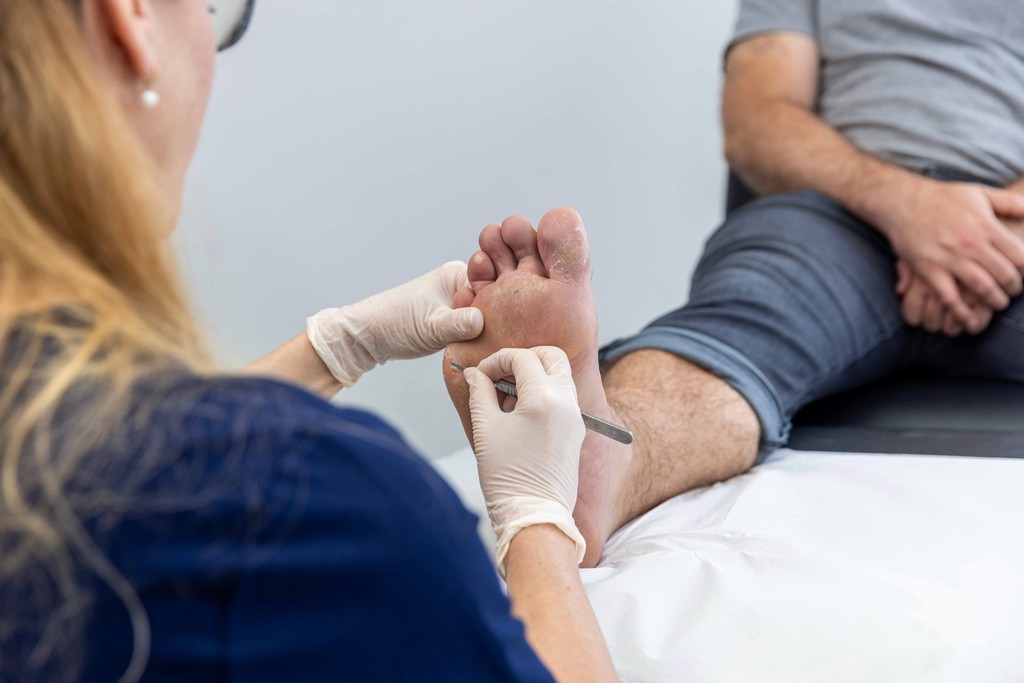 Imaged of a podiatrist woking on a foot using a sharp tool