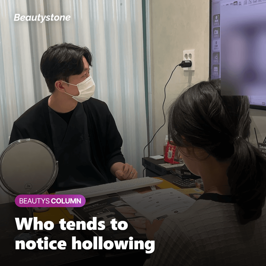 Illustration of who is more likely to notice cheek hollowing after jaw Botox