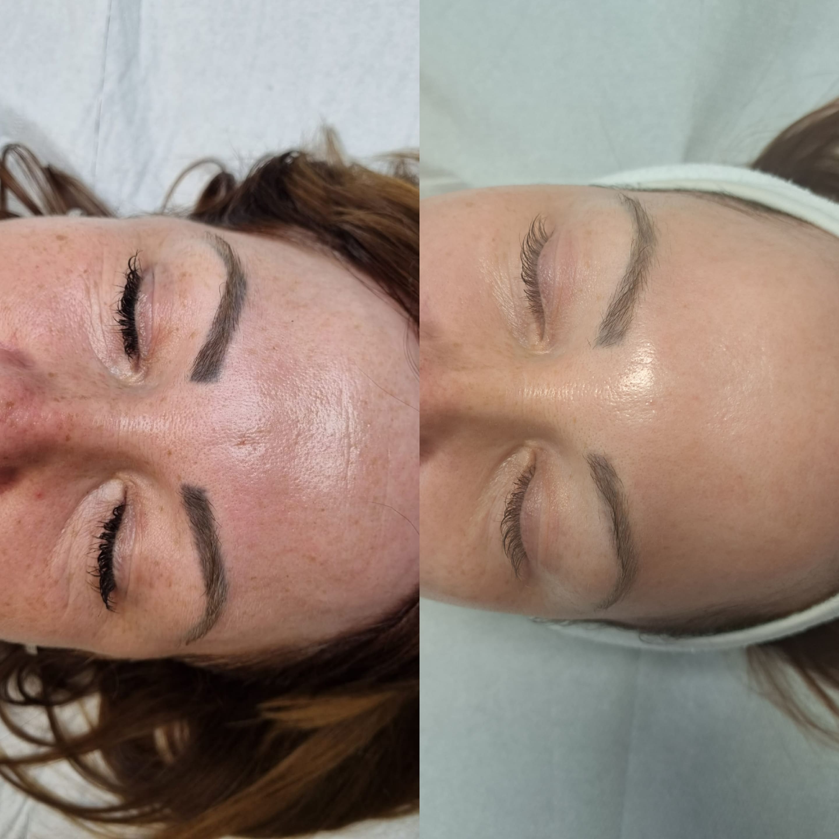 Fotodynamika estGen_leszczenko_efekty_szczecin_antyage