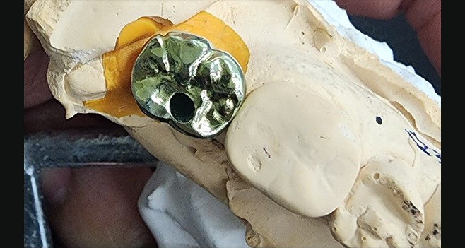 아노다이징 처리