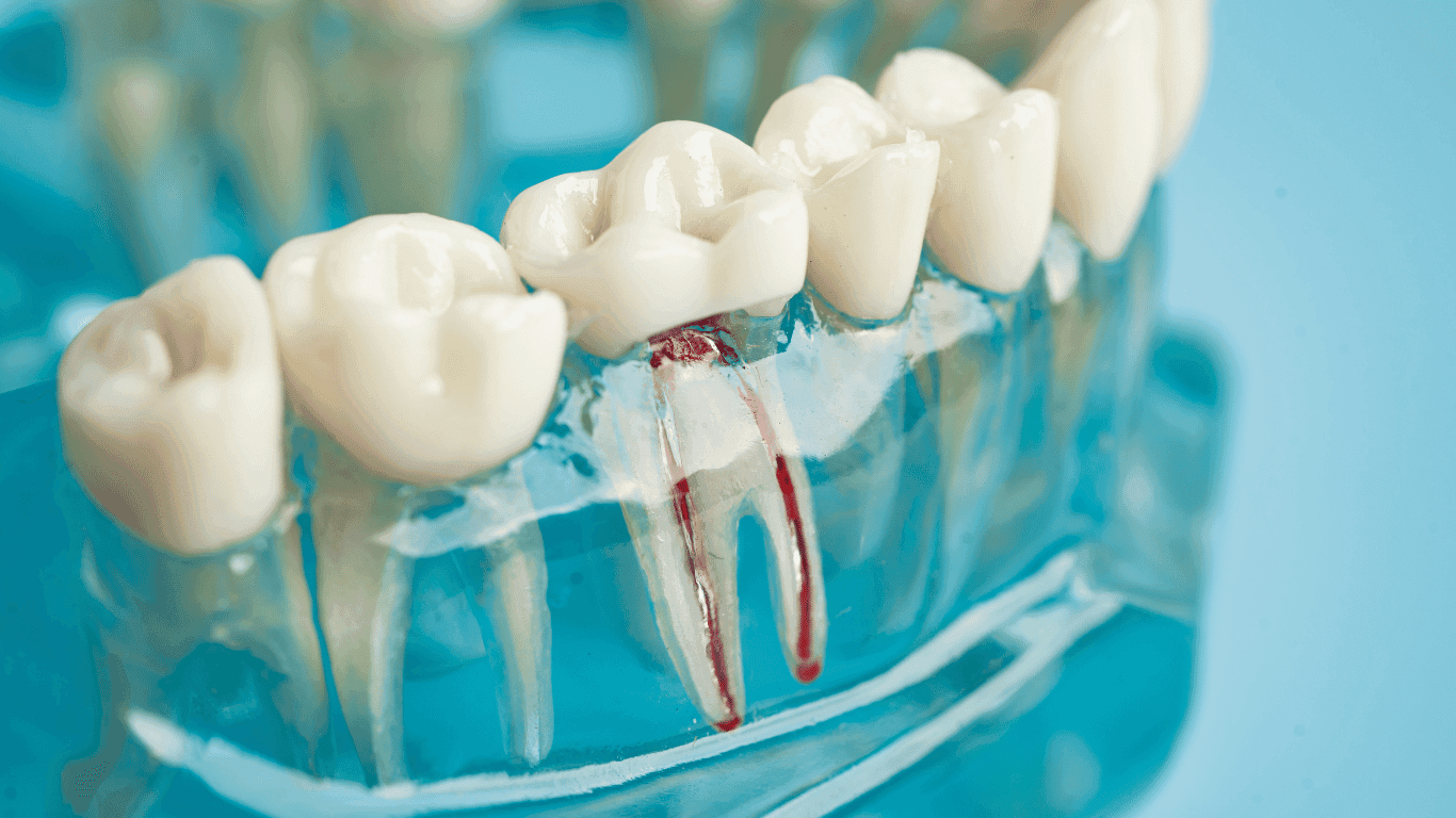 root canal cross section
