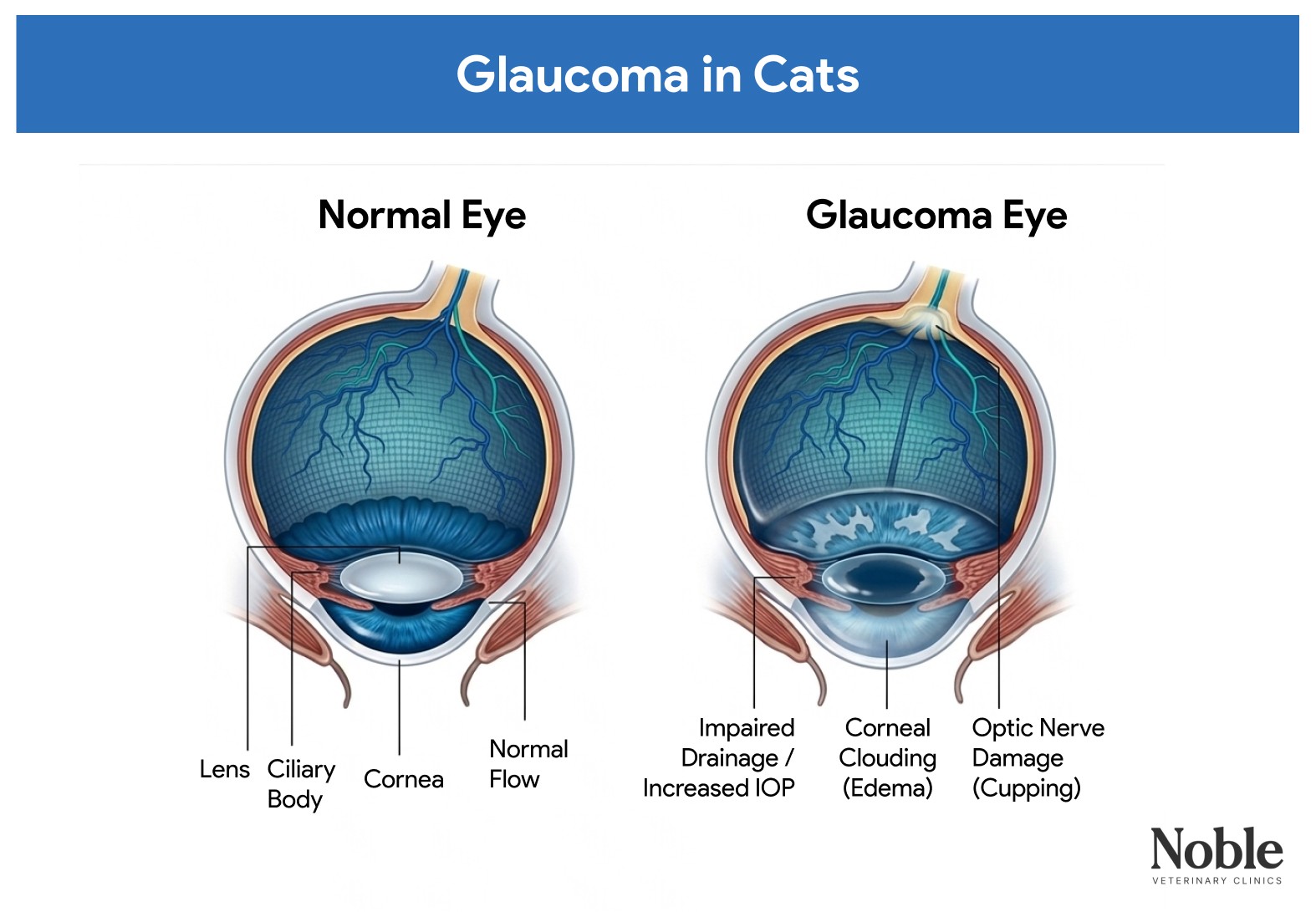 An infogrpahic showing the difference between a normal eye and an eye with glaucoma in cats.