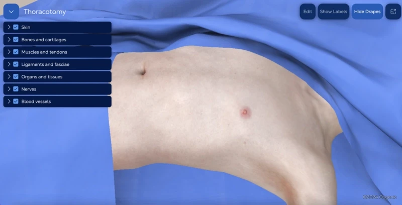 Anterolateral emergency thoracotomy