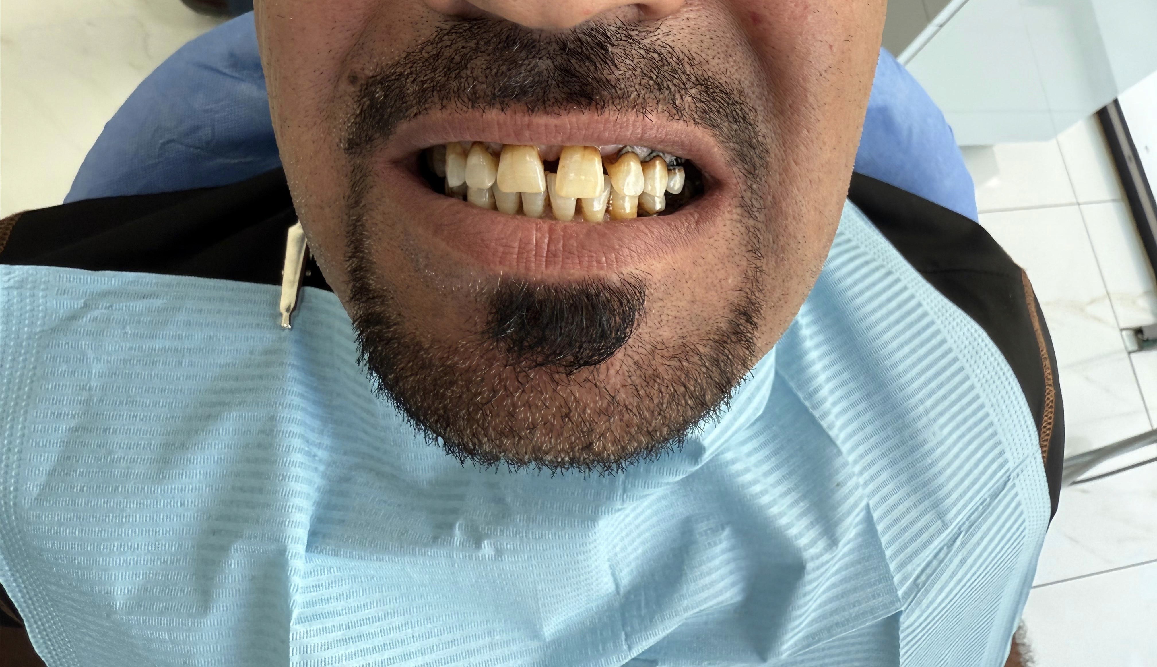 Before Image