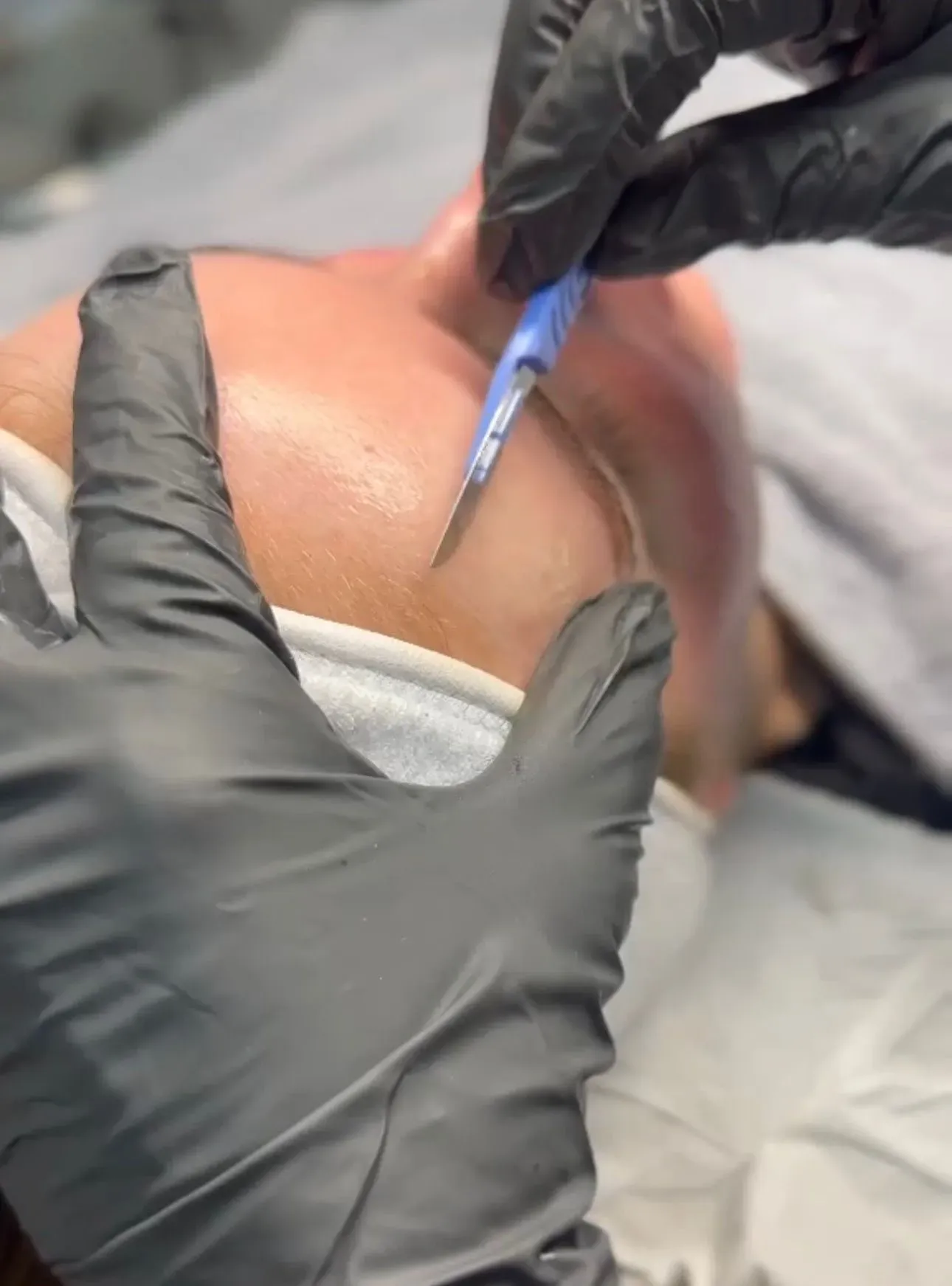 Student wearing black protective gloves performing dermaplane on client forehead