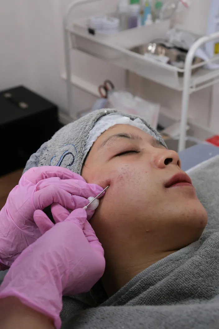 Imagen ilustrativa de paciente recibiendo tratamiento de toxina botulínica en clínica de medicina estética.