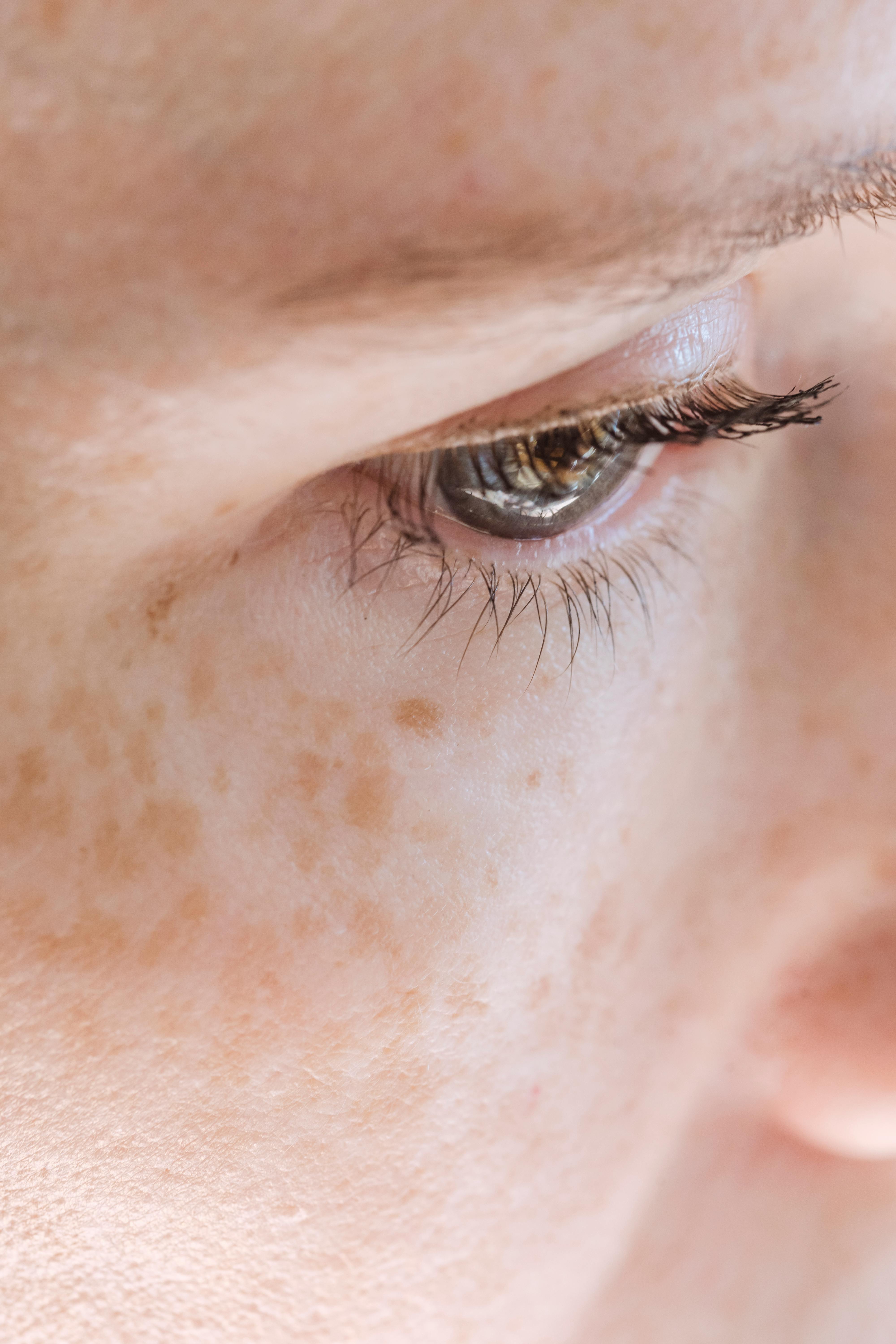 closeup-of-crop-female-with-freckles-and-blue-eyes-pensively-looking-away-in-day - angela-roma (pexels)