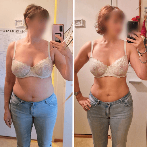Före- och efterjämförelse av en kvinna som gick ner i vikt med RE:YOU-programmet