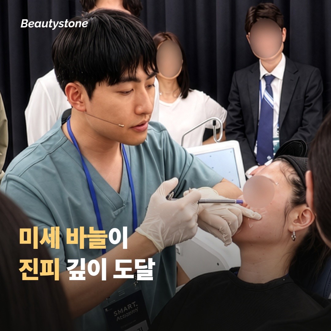 마이크로니들이라는 시술, 어떻게 작동하나요