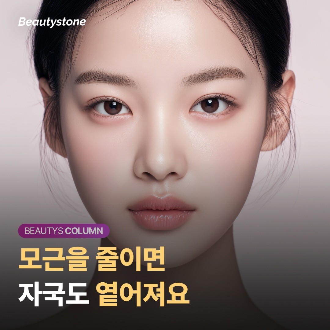 레이저가 옅게 만드는 원리