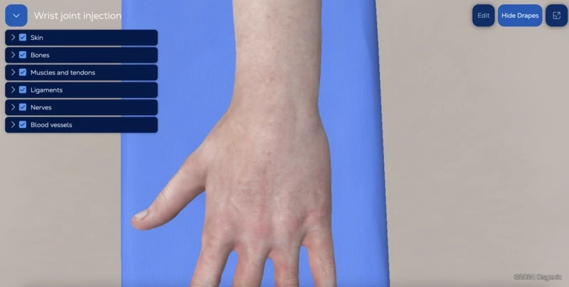 Wrist joint injection (radiocarpal joint)