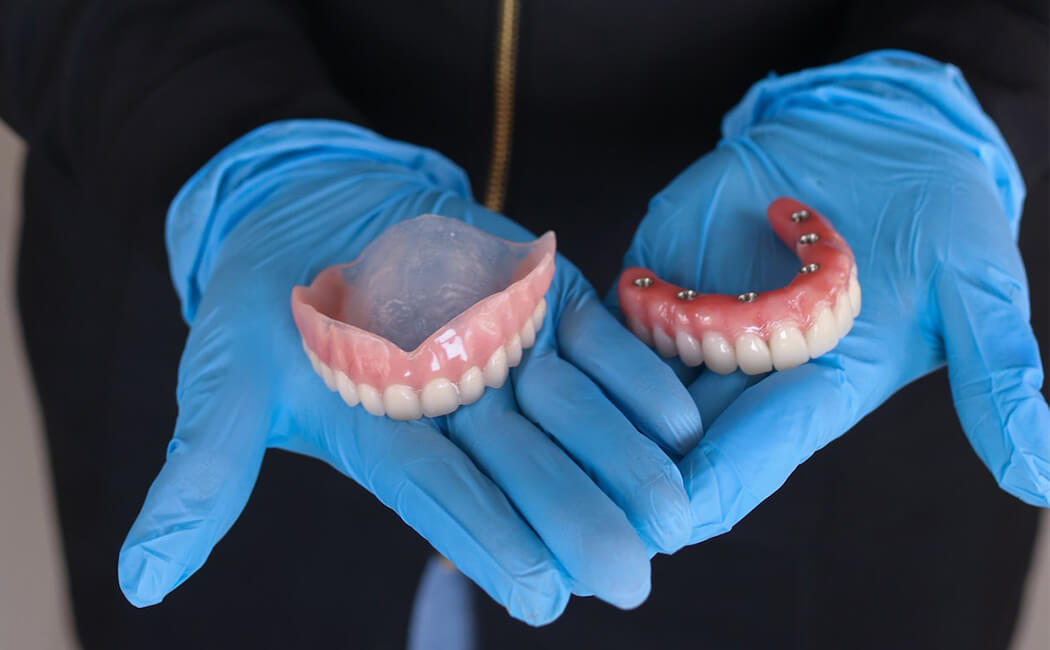 implant supported dentures