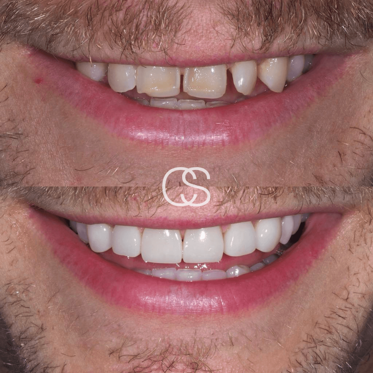 Before & After