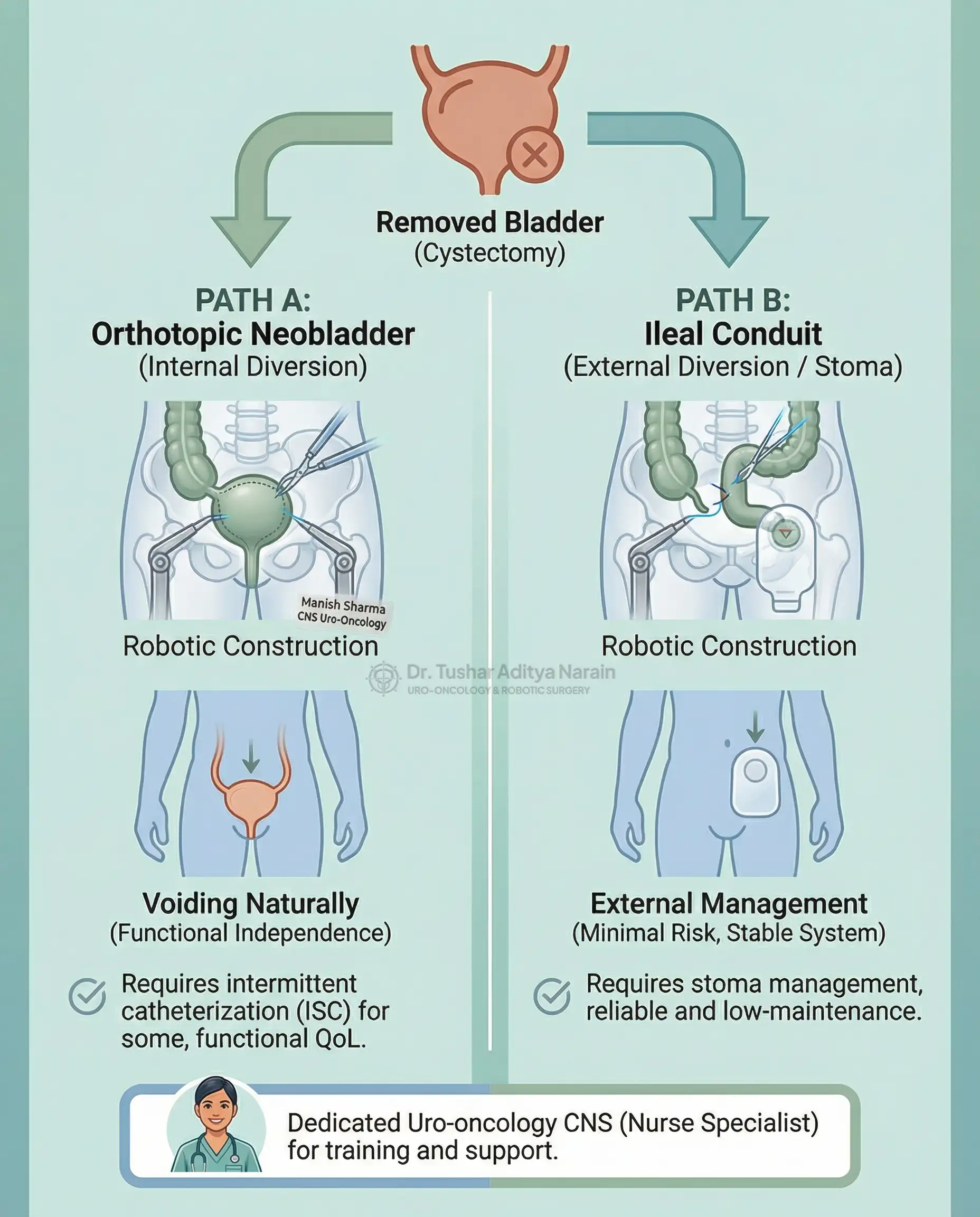 Radical Cystectomy के बाद urinary diversion के लिए schematic decision-support infographic. इसमें Orthotopic Neobladder (functional voiding के लिए internal reconstruction) और Ileal Conduit (विश्वसनीय प्रबंधन के लिए external stoma) के विकल्पों के बीच तुलना की गई है। यह patient choice, Intracorporeal Diversion की complexity, और dedicated nursing support (क्लीनिकल नर्स स्पेशलिस्ट) की भूमिका को उजागर करता है।