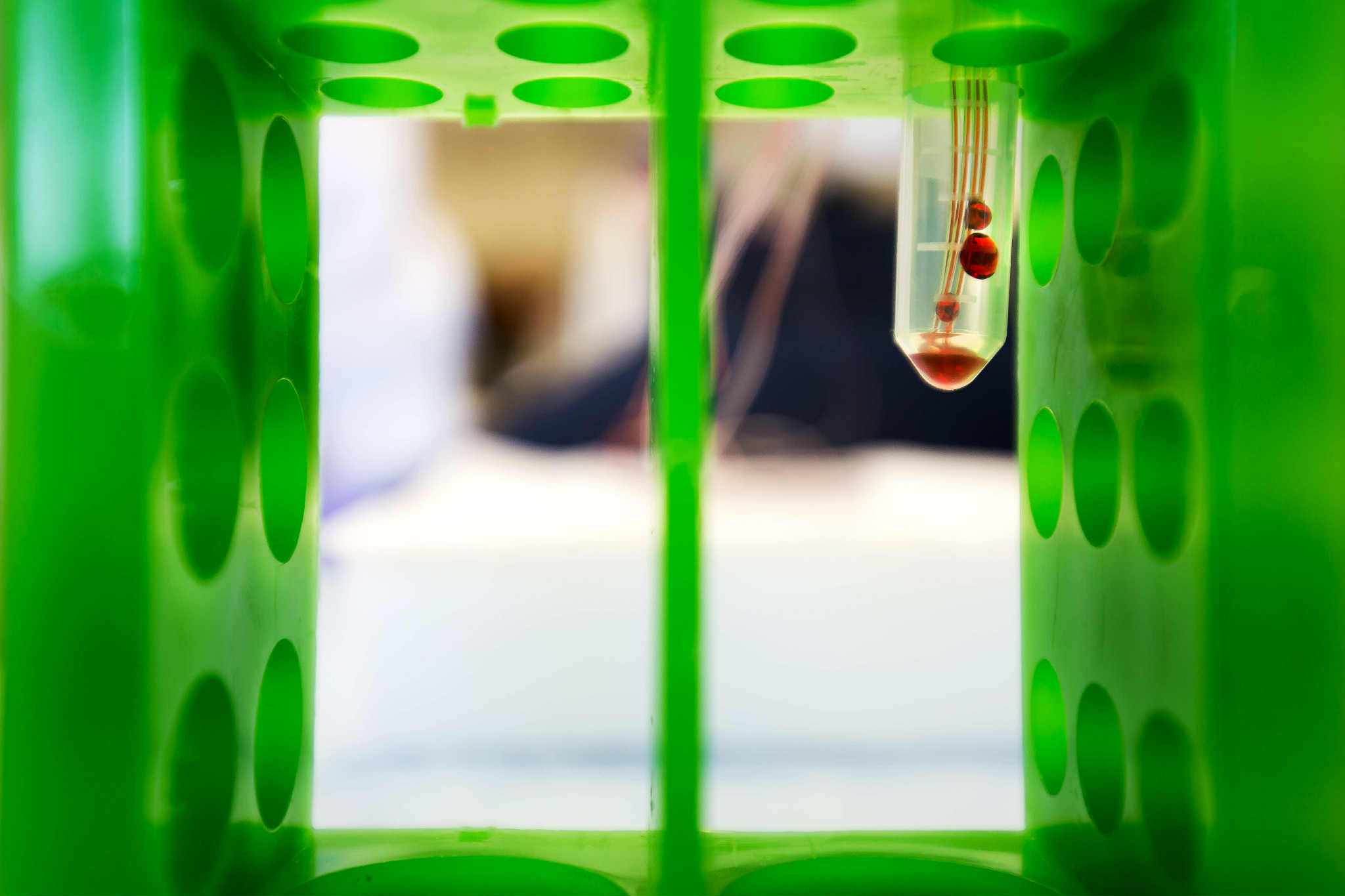 Detecting Circulating Tumor Cells