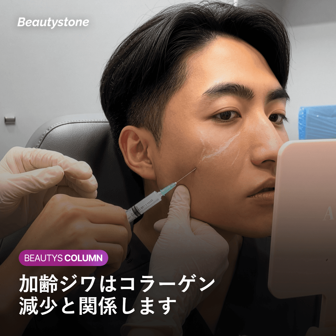 加齢ジワが真皮のコラーゲン減少と関係する仕組みのイメージ