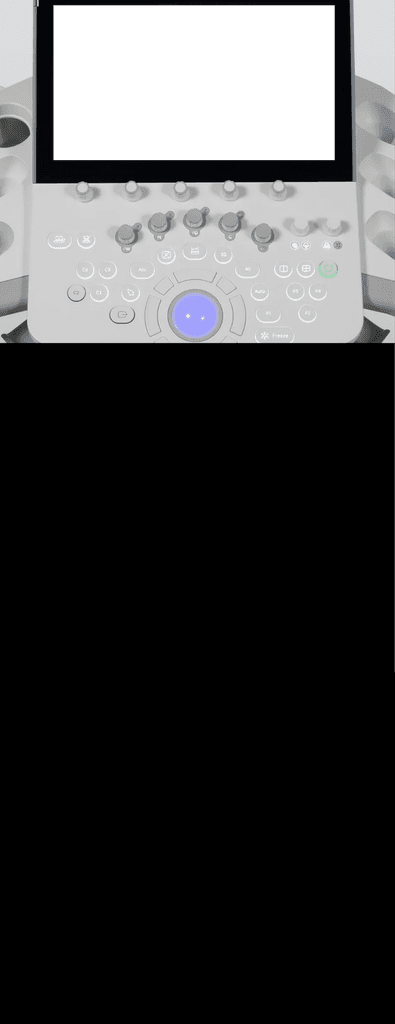 Tablero de ultrasonido con ventana en el display del equipo