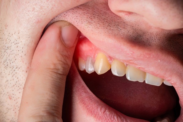 smyrna gum disease treatment