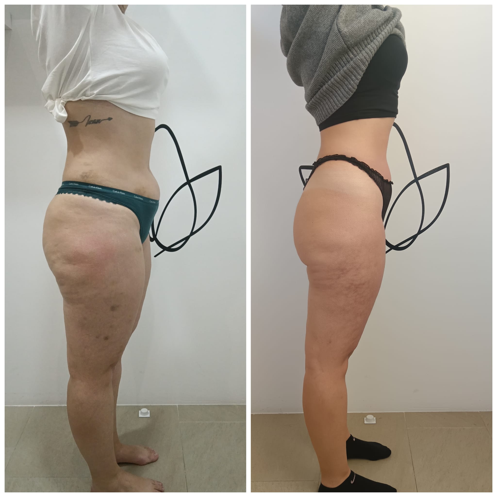 Transformation Photo