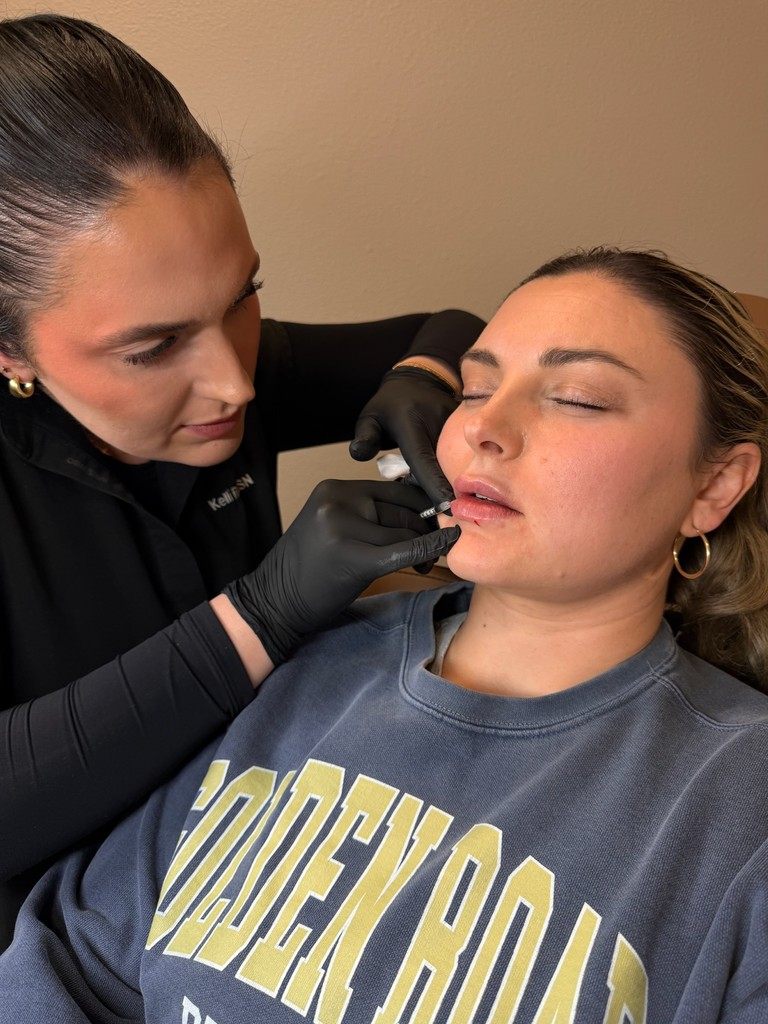 nurse injector performing lip filler injection on client at The Dose Collective Boise