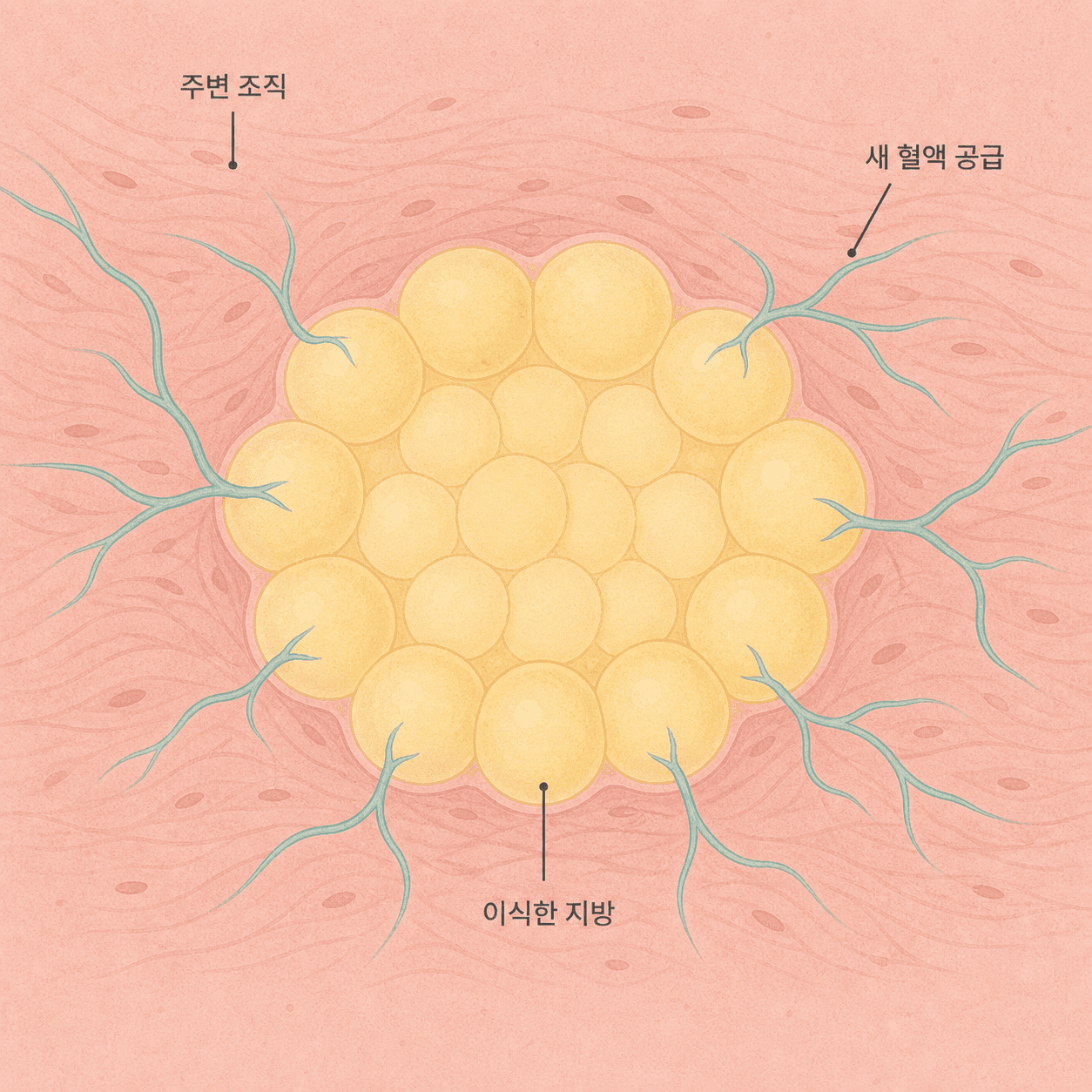 이식한 지방에 주변 조직의 새 혈액 공급이 닿아가는 모습