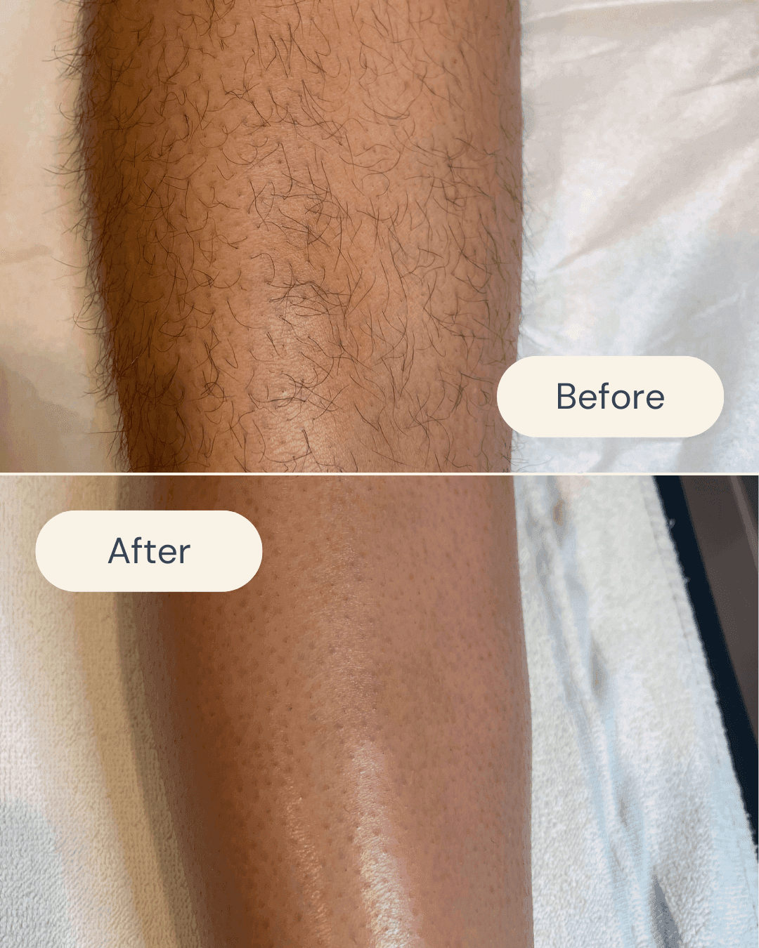 before and after leg waxing with smooth, hair-free results