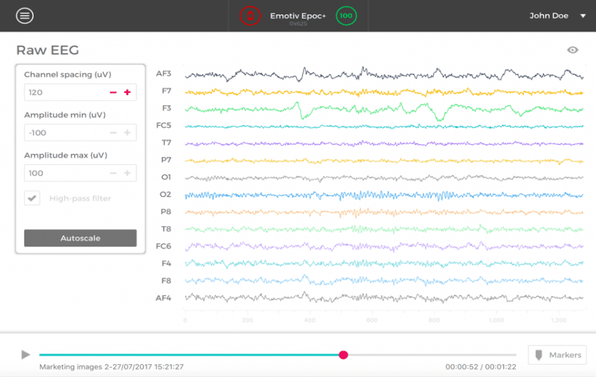 software Image showing a screenshot of eeg monitoring software