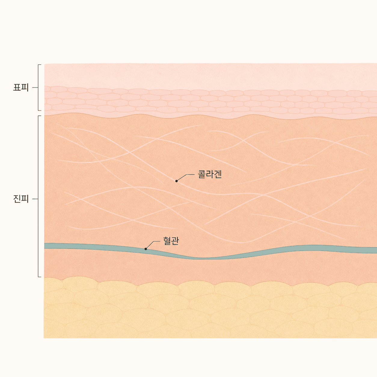 흡연으로 혈류가 줄고 콜라겐이 얇아지는 피부 구조