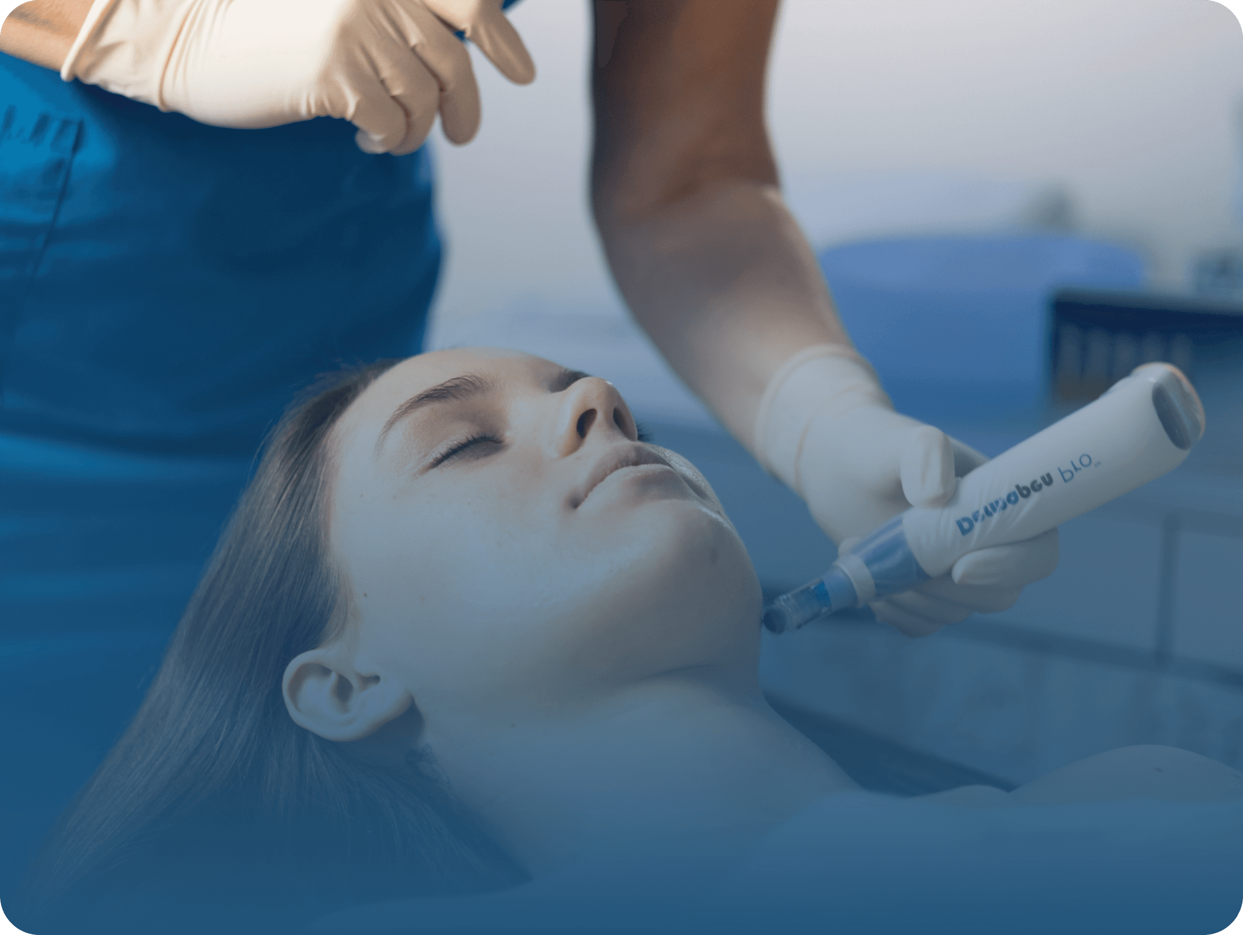 Ošetření pleti přístrojem Dermapen při profesionální kosmetické péči