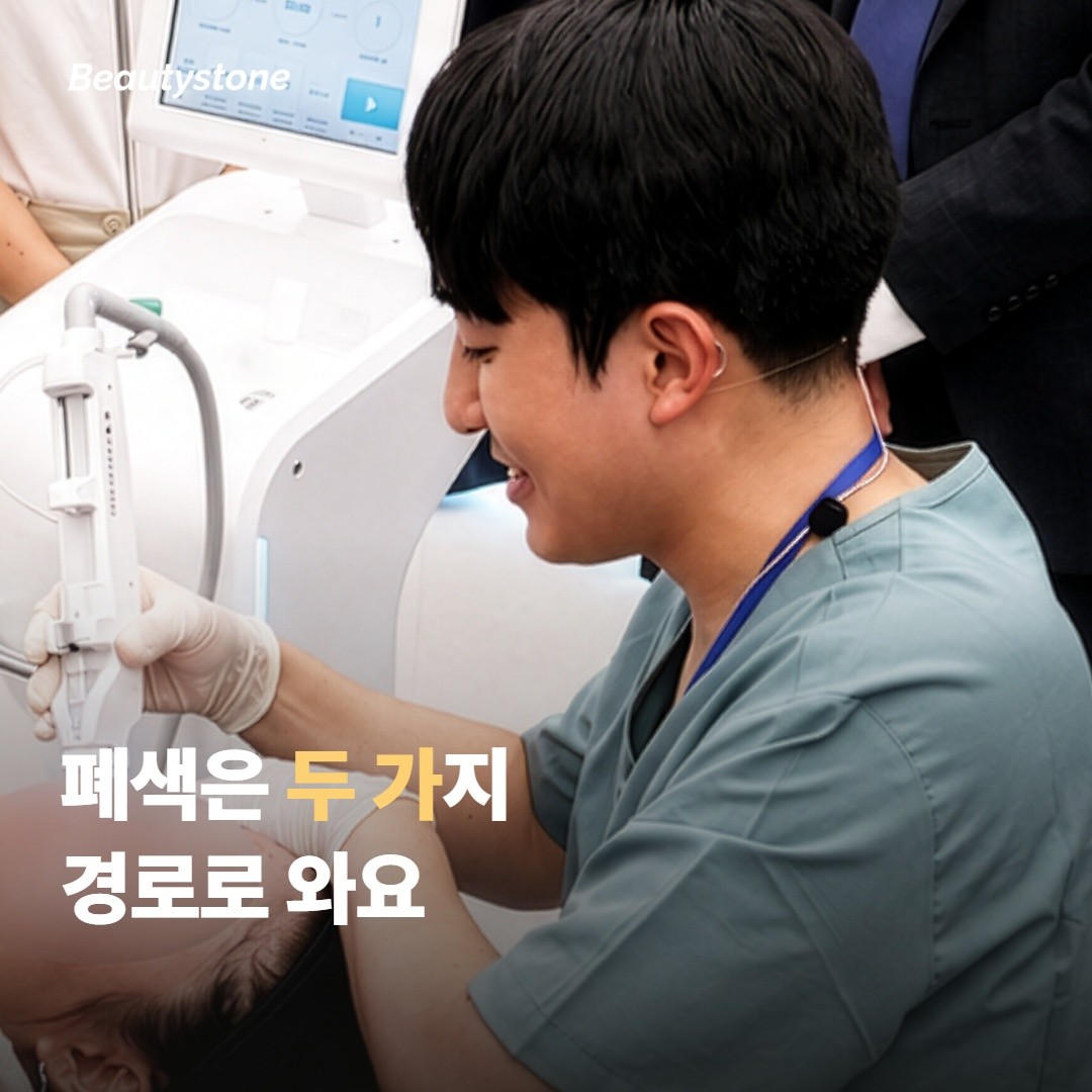 폐색이 일어나는 순간 — 시술 중 두 가지 방식