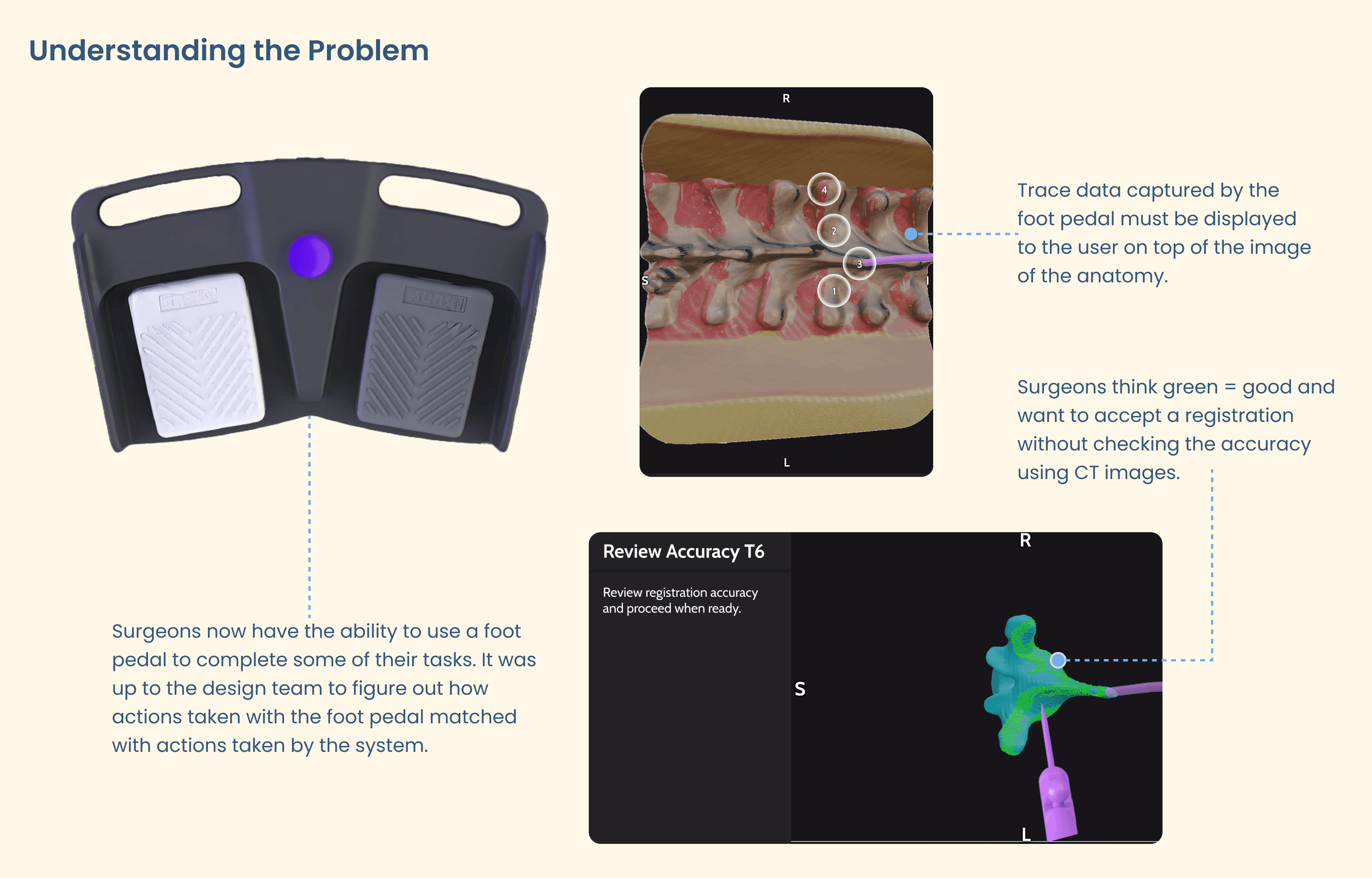 Image of a foot pedal and medical device software describing issues.