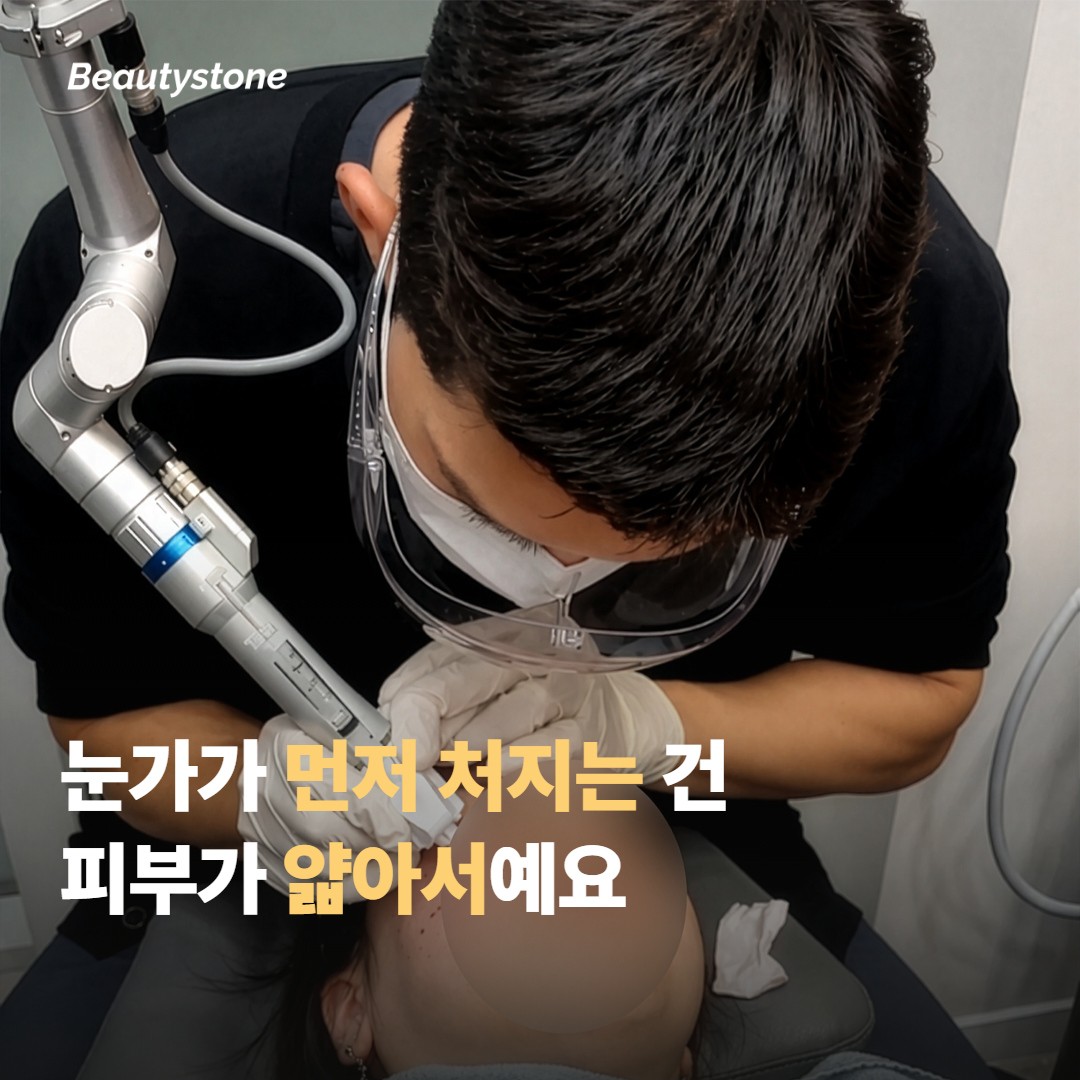 눈가가 유독 먼저 처지는 건 피부가 얇아서예요