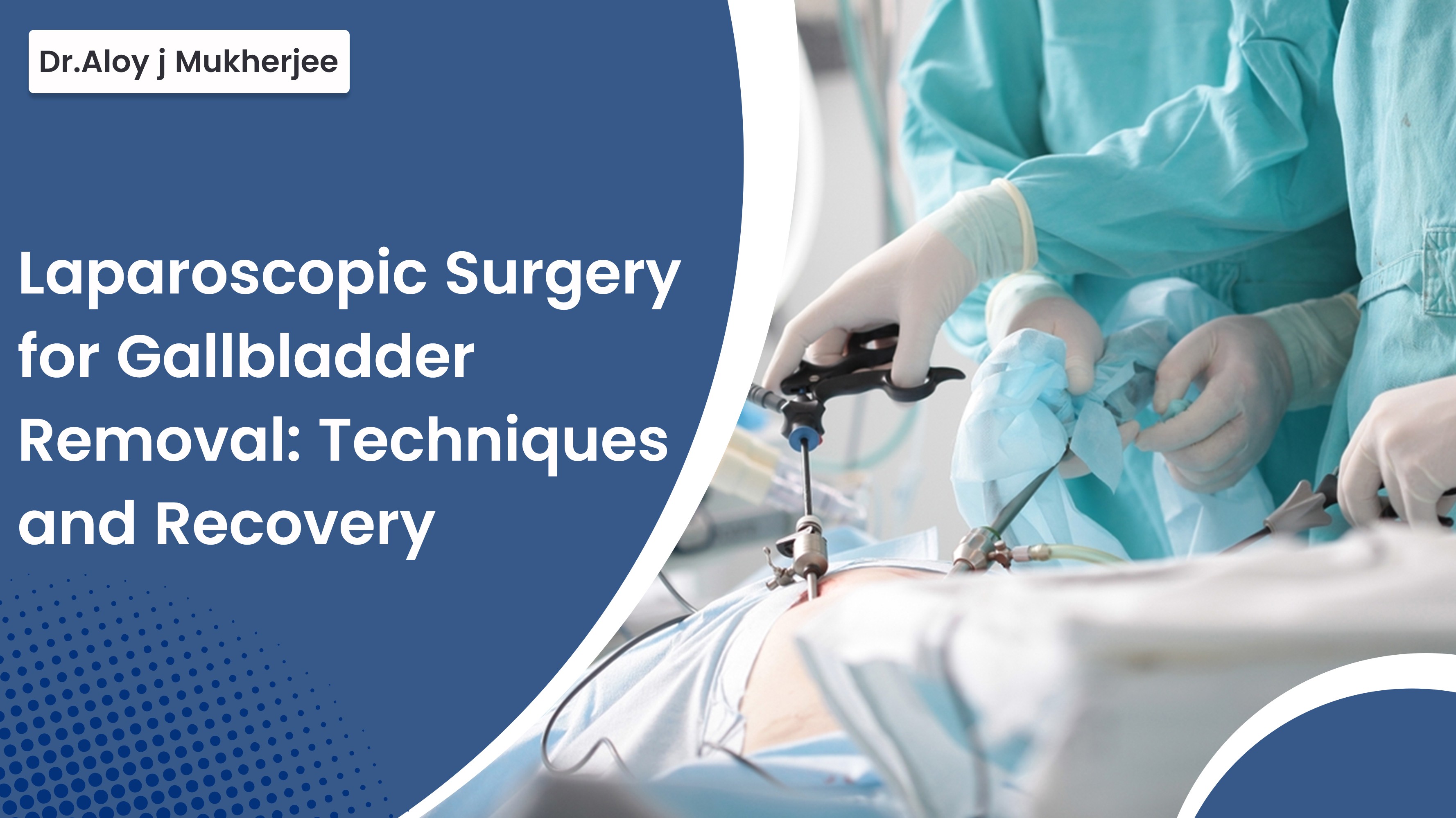 Laparoscopic Surgery for Gallbladder Removal: Techniques and Recovery ...