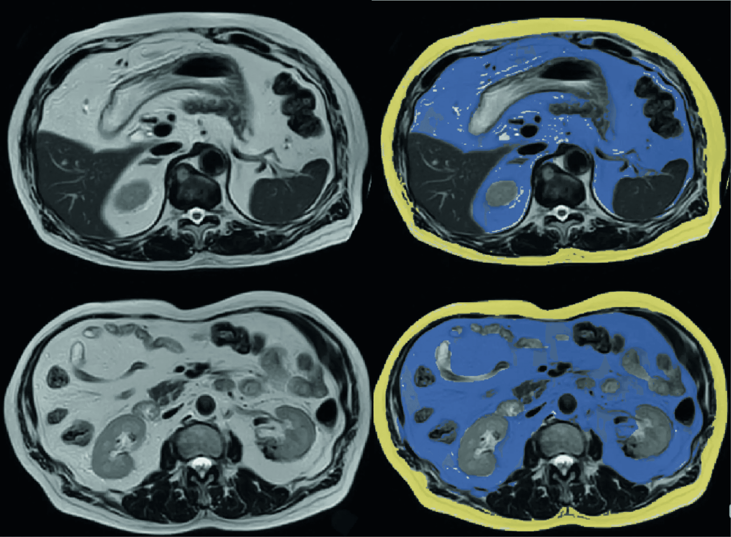a gloved hand holding a test tube filled with liquid